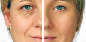 toronto plastic surgery face - before and after